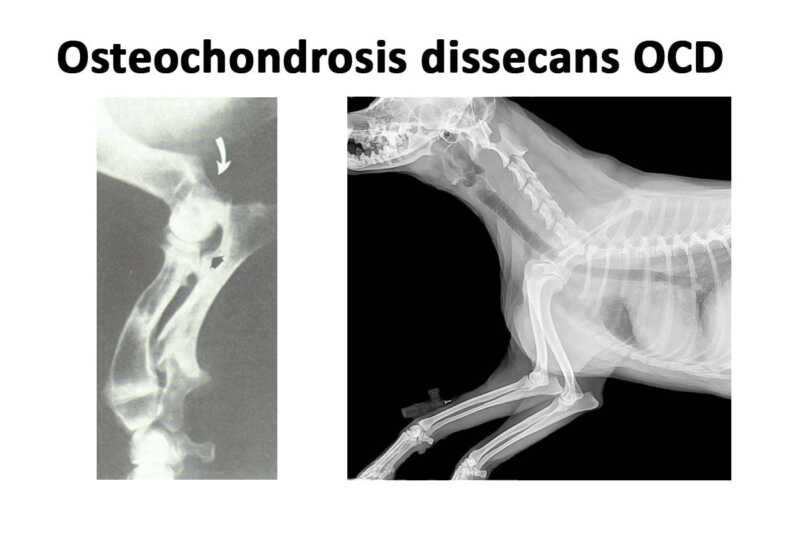 Osteochondrosis dissecans der Trochlea humeri (OCD) GRSK e.V. › ACI e.V.