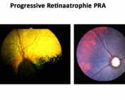 Progressive Retinaatrophie PRA