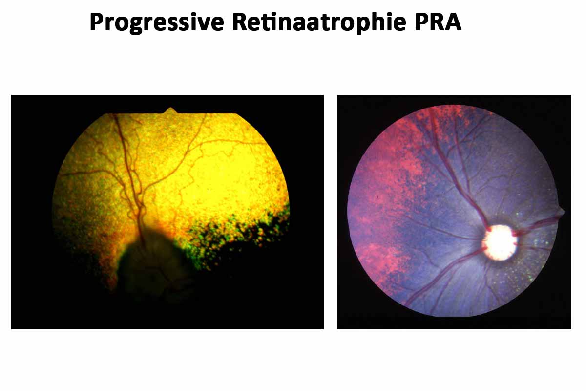 Progressive Retinaatrophie PRA